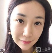 做完熱瑪吉之后，整體的輪廓也是越來越緊致了