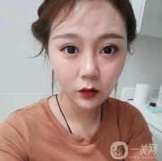 做完熱瑪吉有幾天了，沒有任何不舒服的感覺