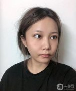 臉部線雕效果好，時(shí)間長(zhǎng)，相對(duì)容易接受微創(chuàng)