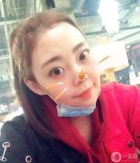 后我決定先做一個光子嫩膚