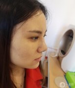 大家好，我終于下定決心做我的鼻子了