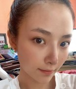 雖然從小到大的朋友都說我長得好看，但我總是對自己的鼻子不滿意