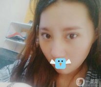 我一直想做鼻子，但是我的鼻子太差了，很難讓它好看