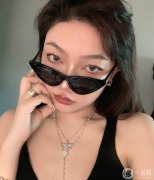 手術(shù)前，我的鼻子很大，山根塌了，側(cè)面看起來像狗鼻子