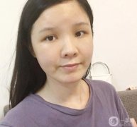 臉部的腫脹正在慢慢減輕，淤青也在消失，越來越正常