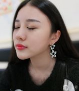 因為我的臉不是很立體，醫(yī)生也建議我在打填一個玻尿酸