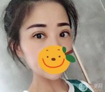 其實(shí)我并沒有突發(fā)奇想，因?yàn)槲业难劬镞€有大大小小的眼睛