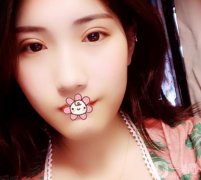 用了20多年，今年終于決定割雙眼皮了