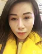 一直想做雙眼皮手術(shù)，但還是猶豫不決，因?yàn)檫@雖然是小手術(shù)，但畢竟還是在臉