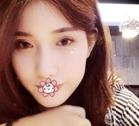 說(shuō)真的，單眼皮真的不好看，用了20多年，今年終于決定割雙眼皮了