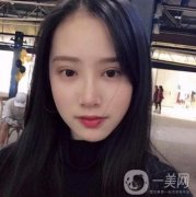 做雙眼皮手術(shù)前，我心里很掙扎，怕沒有做好反倒毀容了