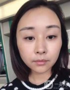 面診時(shí)醫(yī)生說(shuō)面部凹陷相當(dāng)明顯，尤其是臉頰、太陽(yáng)穴、額頭