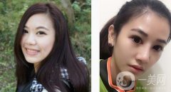 鼻子不立體不精致的體驗(yàn)就是拍照無論從哪個角度看都不好看