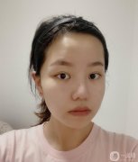 鼻子很大，整個鼻子都很短