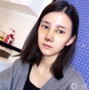 朋友經(jīng)常說我的鼻子，說我的鼻子好像不發(fā)達