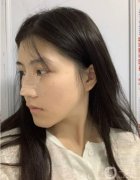 直覺上，如果缺少鼻梁，就要隆鼻