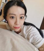 我做線雕的恢復(fù)期很短，別人基本看不到，靜靜的就變美了