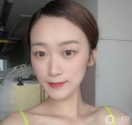 當(dāng)我去打瘦臉針時(shí)，醫(yī)生說(shuō)我的臉實(shí)際上是多肉的，不是因?yàn)橐Ъ?></a>
                            <div   id=