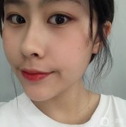 我從小就是肉肉的臉，每次都很煩