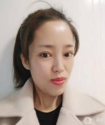 我一直想做雙眼皮手術(shù)，因?yàn)檠劬φ娴暮苡绊懳业拿嬷?></a>
                            <div   id=