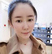 現(xiàn)在臉很自然，填充的部分也很飽滿