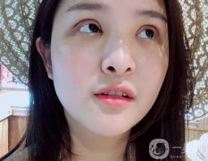 一定要特別注意雙眼皮的恢復(fù)期，說(shuō)怎么剪雙眼皮的睫毛，怎么讓睫毛更長(zhǎng)更密