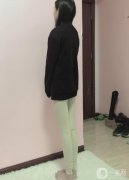 手術前，我了解了很多醫(yī)院和醫(yī)生的抽脂技術