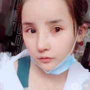 我從小就羨慕別人仰著鼻子，曾經想象過如果我有這樣一個仰著的鼻子該有多美