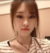 在埋線提升的第15天，到現(xiàn)在為止，感覺(jué)效果很好