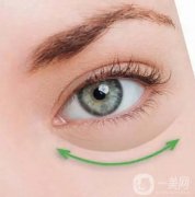 眼袋下垂陰影難看？用對方法輕松解決！