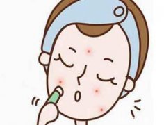 3天快速淡化黑色痘印