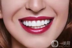 明星大白牙的秘密：如何成為＂LED燈＂般的亮白牙齒?