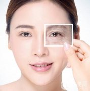 從厭世臉到貓系女，眼睛的美麗與困擾