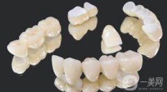 全瓷牙套多少錢一顆價格表2024版，國產(chǎn)和進口品牌的價位范圍對比