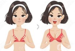 隆胸大概需要多少錢？價格費用表查詢_注意事項、前后對比分享