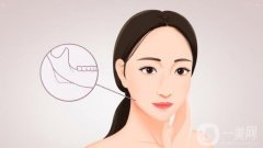 下頜角磨骨手術需要多少錢？危險嗎？全新價格表_注意事項來襲