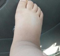 水療教授分享：改良水腫、干燥、脫發(fā)的泡澡秘訣