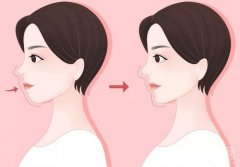 凸嘴焦慮？別再被審美束縛！學(xué)會這些，讓特色變優(yōu)勢