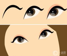 種的睫毛在家怎么卸下來