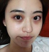 熬夜一時(shí)爽，一直熬夜顏值暴跌！拯救你的肌膚，告別“節(jié)后焦慮”