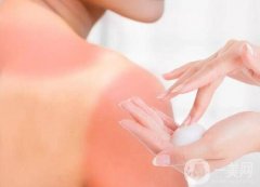 曬后修護(hù)攻略：應(yīng)對(duì)曬傷與暗沉，重拾肌膚光彩