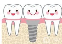 秦皇島種植牙多少錢一顆？?jī)r(jià)格費(fèi)用受哪些因素影響？戳這里了解