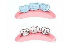 安徽矯正牙齒要多少錢？矯正牙齒的佳年齡分享