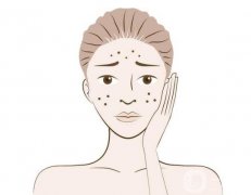 凹陷疤痕修復(fù)手術(shù)一般多少錢？技術(shù)好的醫(yī)院盤(pán)點(diǎn)、對(duì)比分享