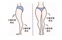 抽脂減肥價(jià)格一覽表2024，抽脂減肥安全性一次了解