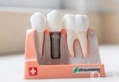 珠海種植牙多少錢一顆？2024珠海便宜又好牙科機(jī)構(gòu)推薦