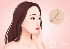 北大深圳醫(yī)院隆鼻案例分享！附崔永言、李天石醫(yī)生專業(yè)擅長(zhǎng)一覽