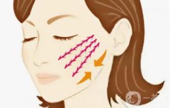 上海張曉建醫(yī)生拉皮多少錢？手術(shù)價(jià)格、醫(yī)生簡(jiǎn)介、口碑大測(cè)評(píng)