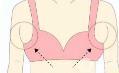 切除副乳安全嗎？有危害嗎