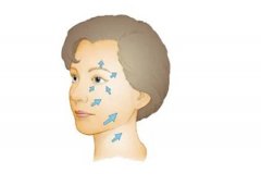 去除眉間皺紋的方法有哪些